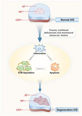 Circular RNA and intervertebral disc degeneration: unravelling mechanisms and implications